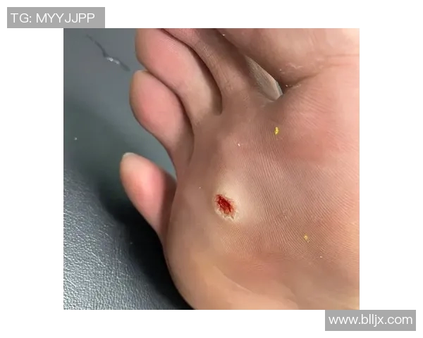 足球明星扭伤脚真实图片曝光引发球迷热议与关心